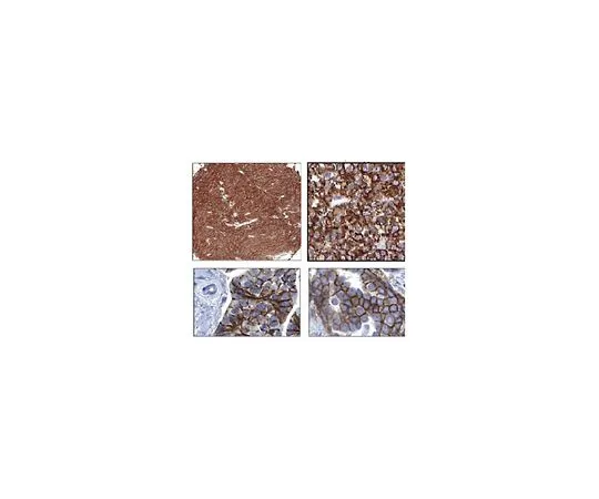 62-8523-87 Anti-ROR2 Antibody, clone Nt 2535-2835 MABS1152