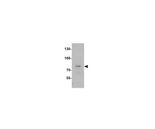 62-8470-04 Anti-Fat Free ABS441
