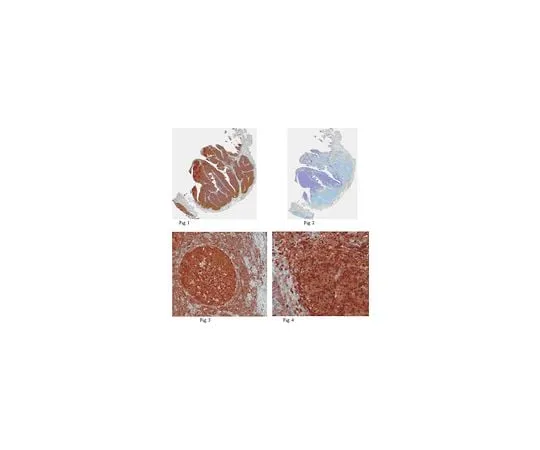62-8469-46 Anti-HPK1 ABS159