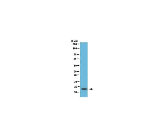 62-8469-85 Anti-Fatty-acid binding protein 5 Antibody Cat. No. ABS312 ABS312