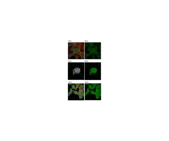 62-8501-89 Anti-Tankyrase-1/TNKS, clone 7D1.2 MABC286