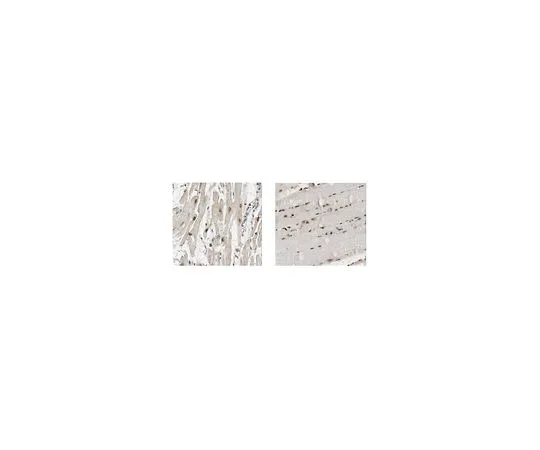62-8507-35 Anti-26S proteasome non-ATPase regulatory subunit 14 MABE881