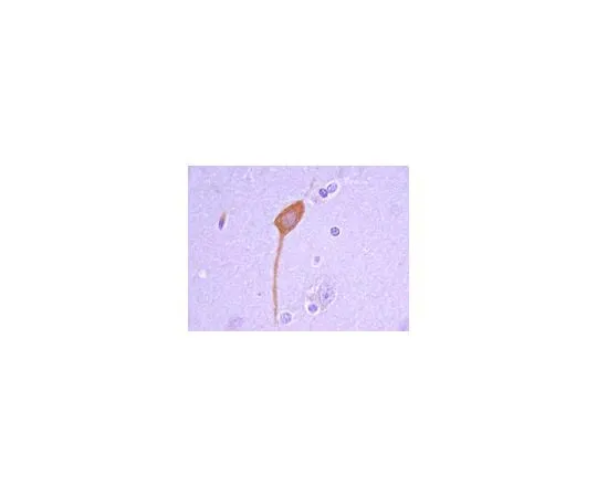 62-8497-80 Anti-GAD67, clone 1G10.2; 100 μg MAB5406