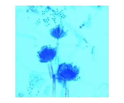 61-0311-75 Lactophenol Blue Stain Solution for Fungal Stain 113741 100mL 1.13741.0100