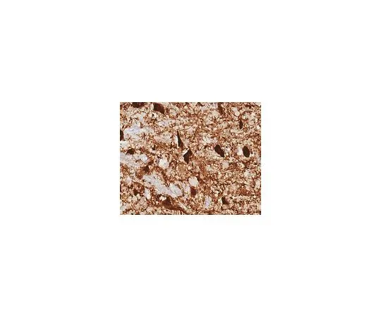 62-8520-71 Anti-Tyrosine Hydroxylase Antibody, clone 10F8.2 MABN1188