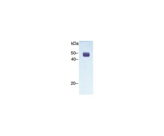 62-8480-68 Urokinase-type Plasminogen Activator; 100 μg CC4000