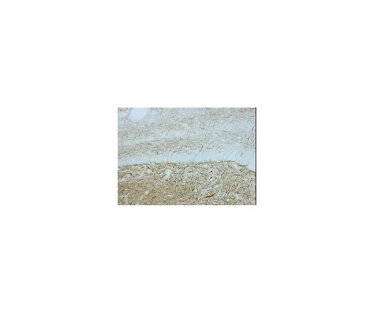 62-8497-36 Anti-Neurofilament 200 kDa, clone N52; 50 μg MAB5266