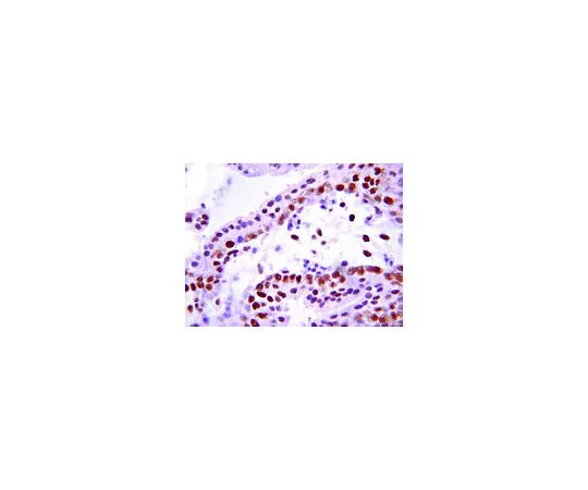62-8521-92 Anti-Insulin Receptor, beta subunit, clone CT-3; 100 μg MABS65