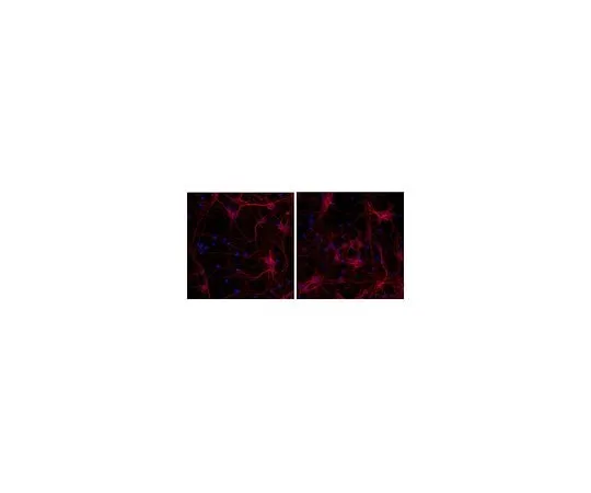 62-8479-67 Anti-Tubulin β-III, clone TU-20, Alexa Fluor(R)555 Conjugate; 100 μL CBL412A5