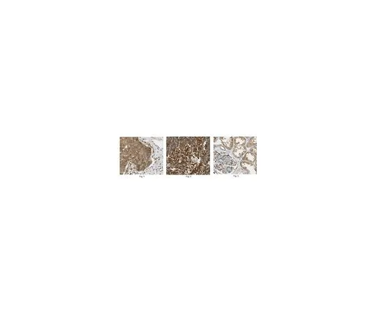 62-8501-44 Anti-LDH-A, clone 5D2.1 MABC150