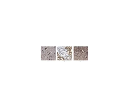 62-8470-78 Anti-3-PGDH ABS571