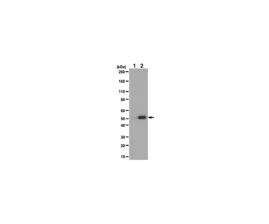 62-8473-24 Anti-acetyl Tubulin (Lys40) ABT241