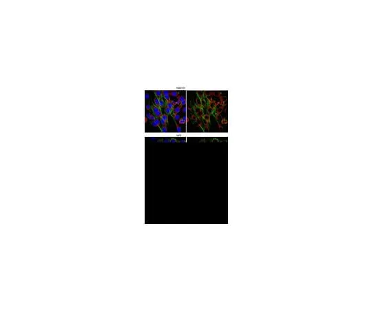 62-8472-55 Anti-WASH complex subunit FAM21C; 100 μg ABT79