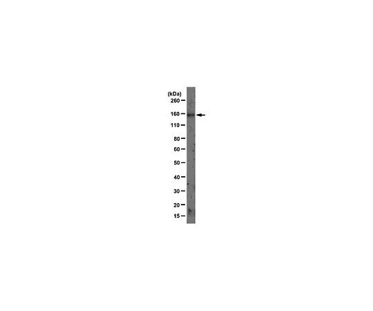 62-8521-80 Anti-LDLR, clone C7; 100 μg MABS26