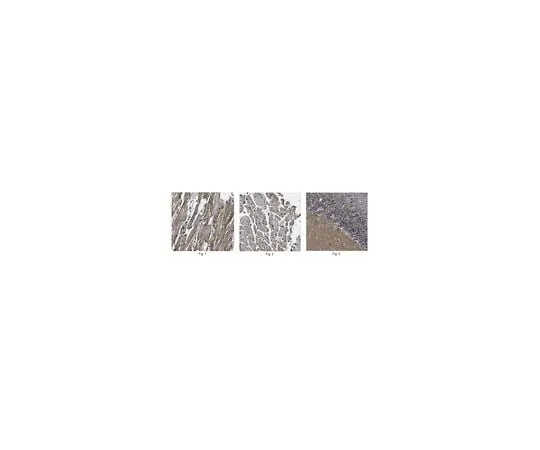 62-8473-13 Anti-Pro-neuregulin-1 ABT179
