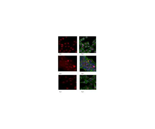 62-8501-68 Anti-PIDD Antibody, clone 1511.1 Cat. No. MABC189 MABC189