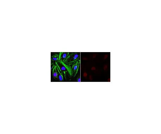 62-8522-11 Anti-O-Linked N-Acetylglucosamine Antibody, clone RL2 MABS157