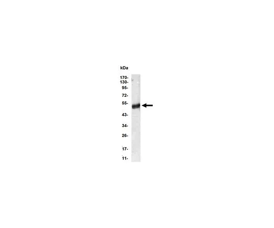 62-8523-70 Anti-AGT, clone 1B1 Antibody MABS817