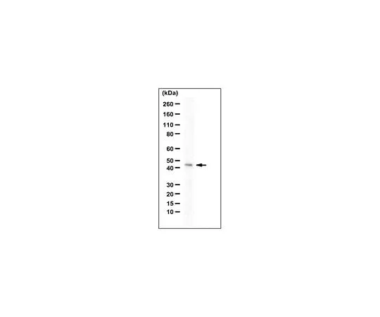 62-8471-77 Anti-ERLIN1/SPFH1 Antibody, C-terminus ABS1611