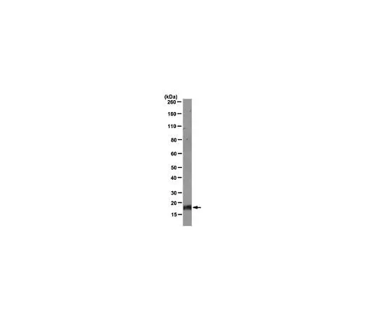 62-8505-32 Anti-ID4, clone DML07; 100 μg MABE164