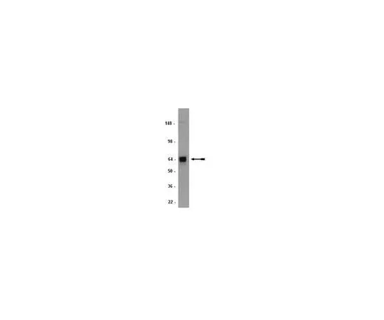 62-8491-93 Anti-ADAMTS-1, clone 5D4E11B6; 100 μL MAB1810