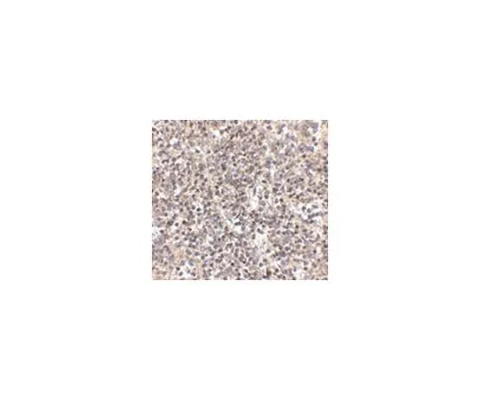 62-8470-01 Anti-RSPO1 ABS437