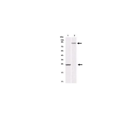 62-8523-60 Anti-IKBKB, clone 10A2 Antibody MABS807