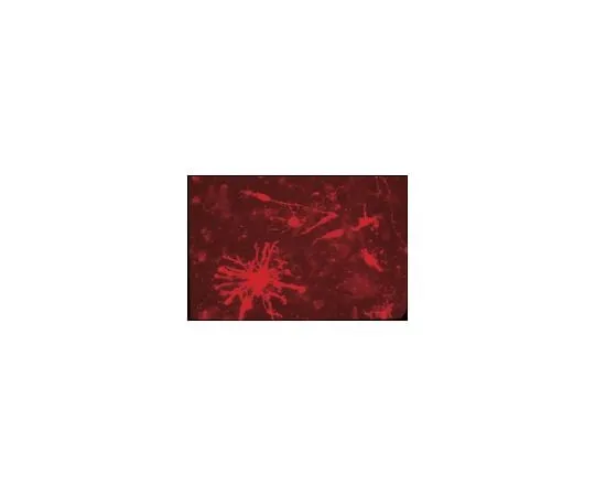 62-8491-36 Anti-Chondroitin Sulfate Proteoglycan, Core Protein Epitope, clone Cat-315; 100 μL MAB1581