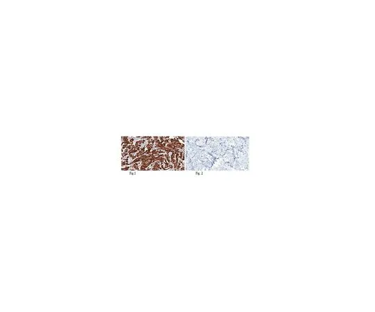 62-8505-88 Anti-c-ErbB2/c-Neu, clone 3B5 MABE330