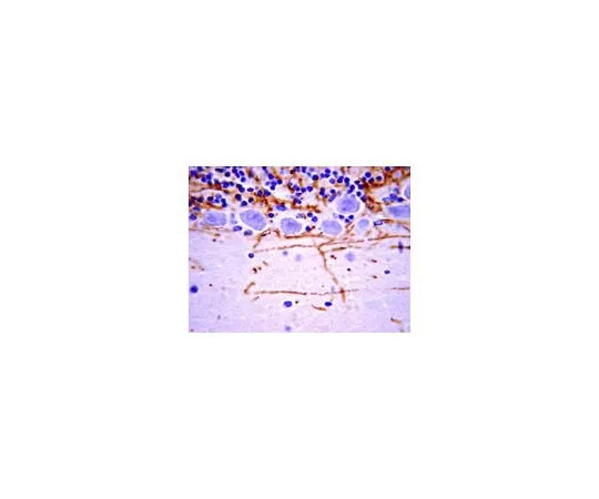 62-8489-26 Anti-Myelin Basic Protein, a.a. 129-138, clone 1; 2 mL MAB382