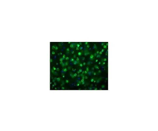 62-8468-83 Anti-MeCP2 ABN1728