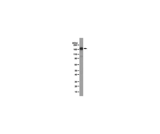 62-8493-98 Anti-Endosialin, clone B1/35; 200 μL MAB2626