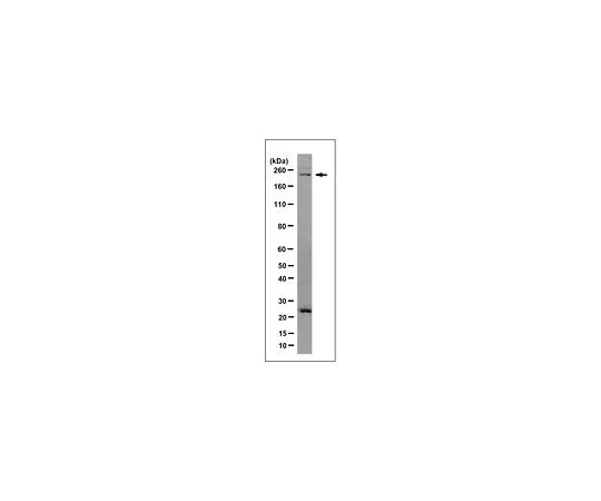62-8505-84 Anti-JARID1D/KDM5D Antibody, clone 7F10.4 MABE326