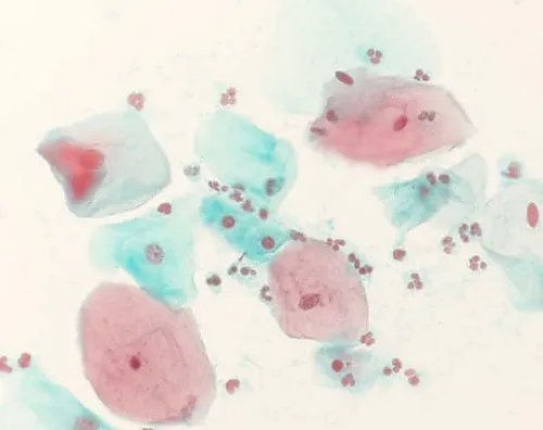 61-0306-69 Shorr Staining Solution Hormone Test, Cytodiagnosis Staining Solution 109275 500mL 1.09275.0500