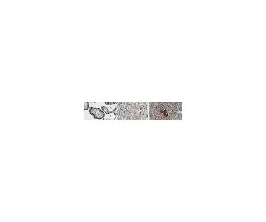 62-8521-36 Anti-TPP1 Antibody, clone 2E12 MABN1806