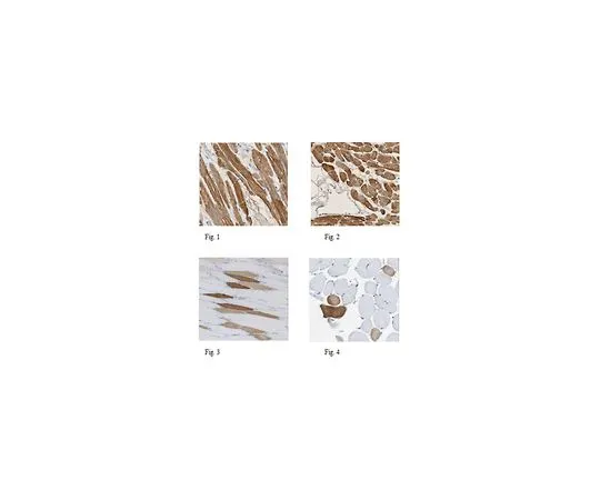 62-8525-90 Anti-MLC-2, clone 19D3.1 MABT180