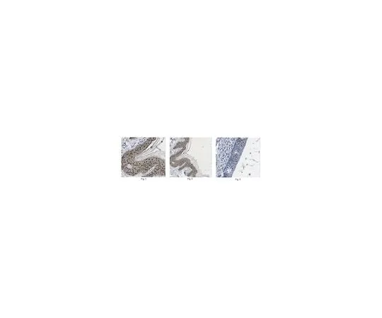 62-8473-44 Anti-Galectin-7 ABT277