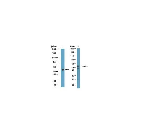 62-8494-93 Anti-Desmin, clone DE-B-5; 40 μg MAB3430