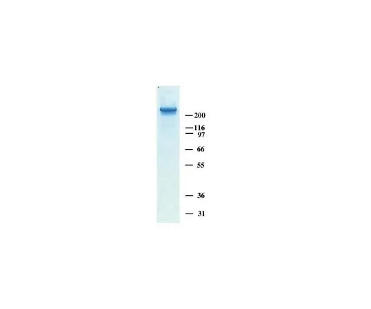 62-8480-30 Human Tenascin-C Purified Protein; 100 μg CC065