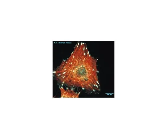 62-8492-70 Anti-Integrin alphaV, clone LM142; 100 μL MAB1978