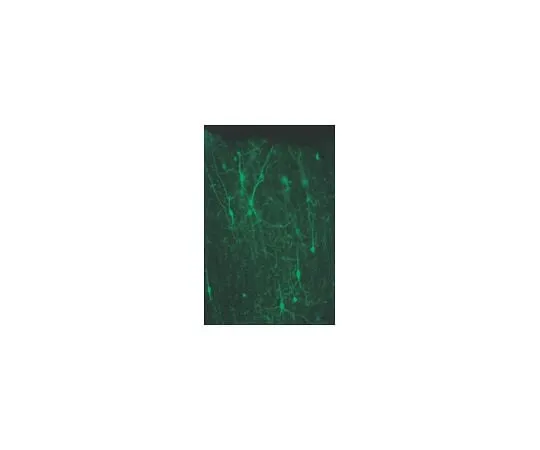 62-8491-28 Anti-Calretinin, clone 6B8.2; 100 μg MAB1568