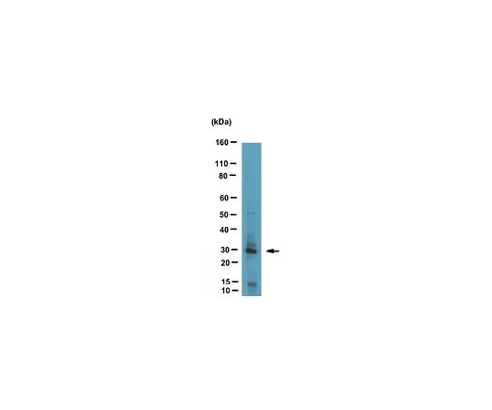 62-8500-22 Anti-Red fluorescent protein, clone 1DS-1A6; 100 μL MAB10765