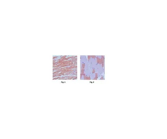 62-8526-62 Anti-MYL3, clone 7C1 MABT495
