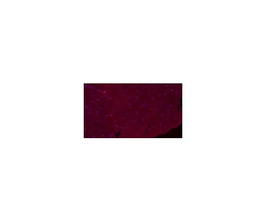 62-8527-04 Anti-Dystrophin Antibody, clone 2C6 (MANDYS106), Alexa Fluor(R) 555 Conjugate MABT827-AF555