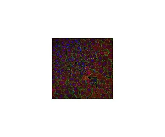 62-8470-62 Anti-Arginase-1 ABS535