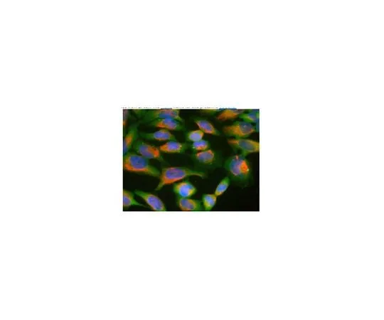 62-8519-52 Anti-Ubiquilin 2, clone 6H9 MABN763