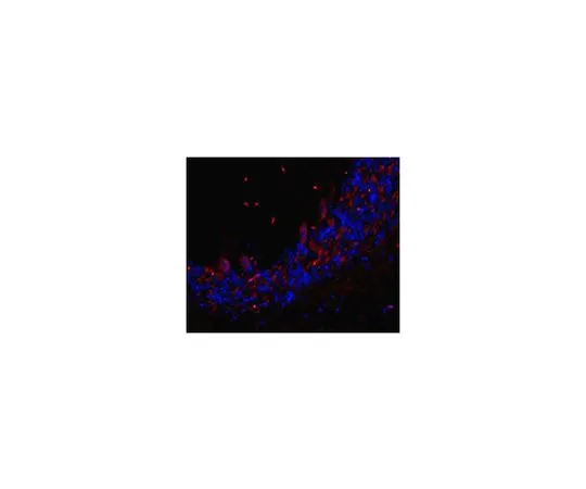 62-8517-95 Anti-TMEM106B Antibody, clone TME-N 6F2 Cat. No. MABN473 MABN473
