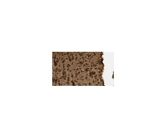 62-8519-49 Anti-Beta-glucosidase 2 (GBA2) Antibody, clone 4A12 MABN757