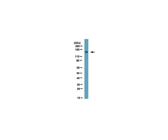 62-8469-13 Anti-FHOD1; 100 μg ABS53