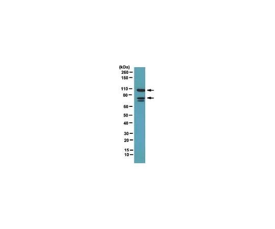 62-8472-27 Anti-Amphiphysin II; 100 μL ABT21